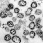 Patient in N.J. dies of Lassa Fever, says CDC